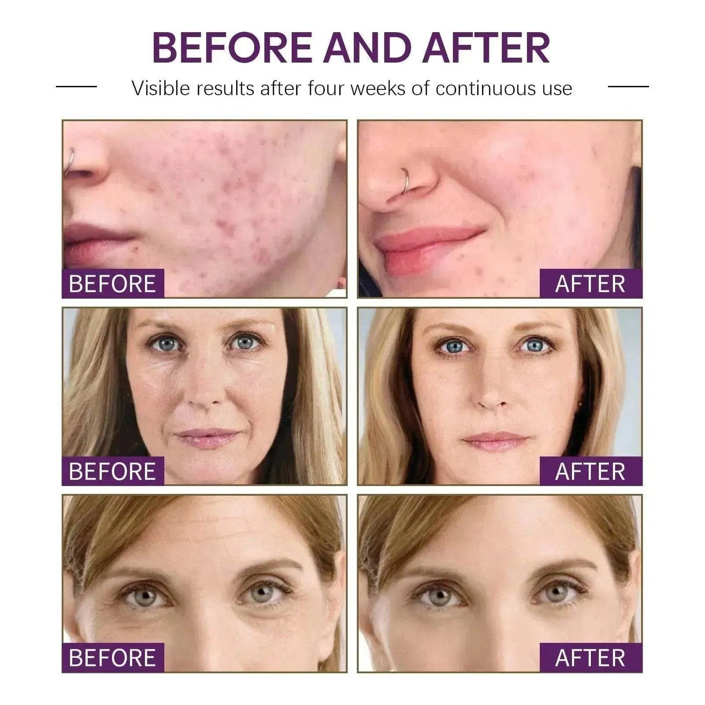 Face Moisturizing Cream Firming Moisturizing Skin Anti-wrinkle - Velora