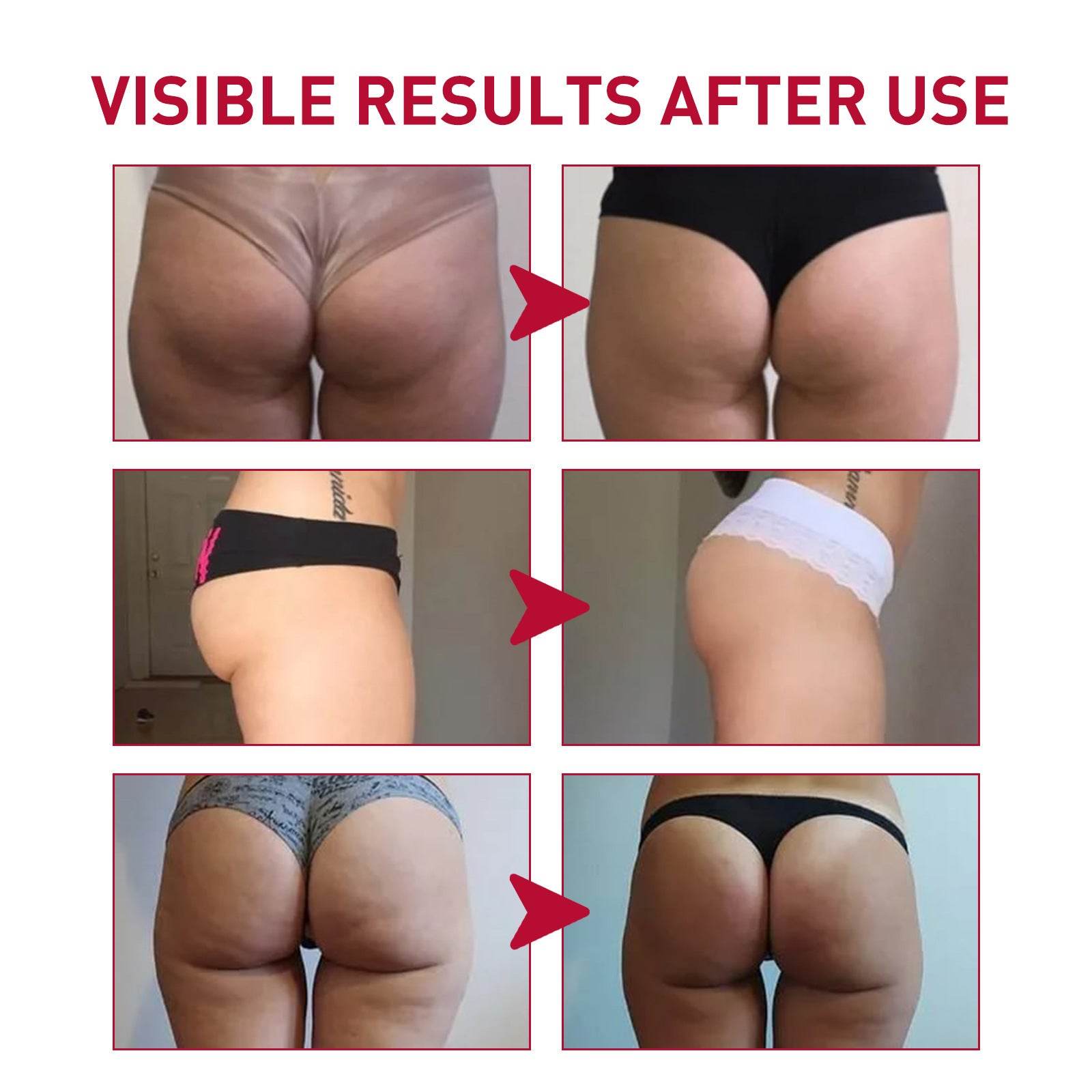 Plump Buttock Cream Lifts And Tightens Buttocks - Velora