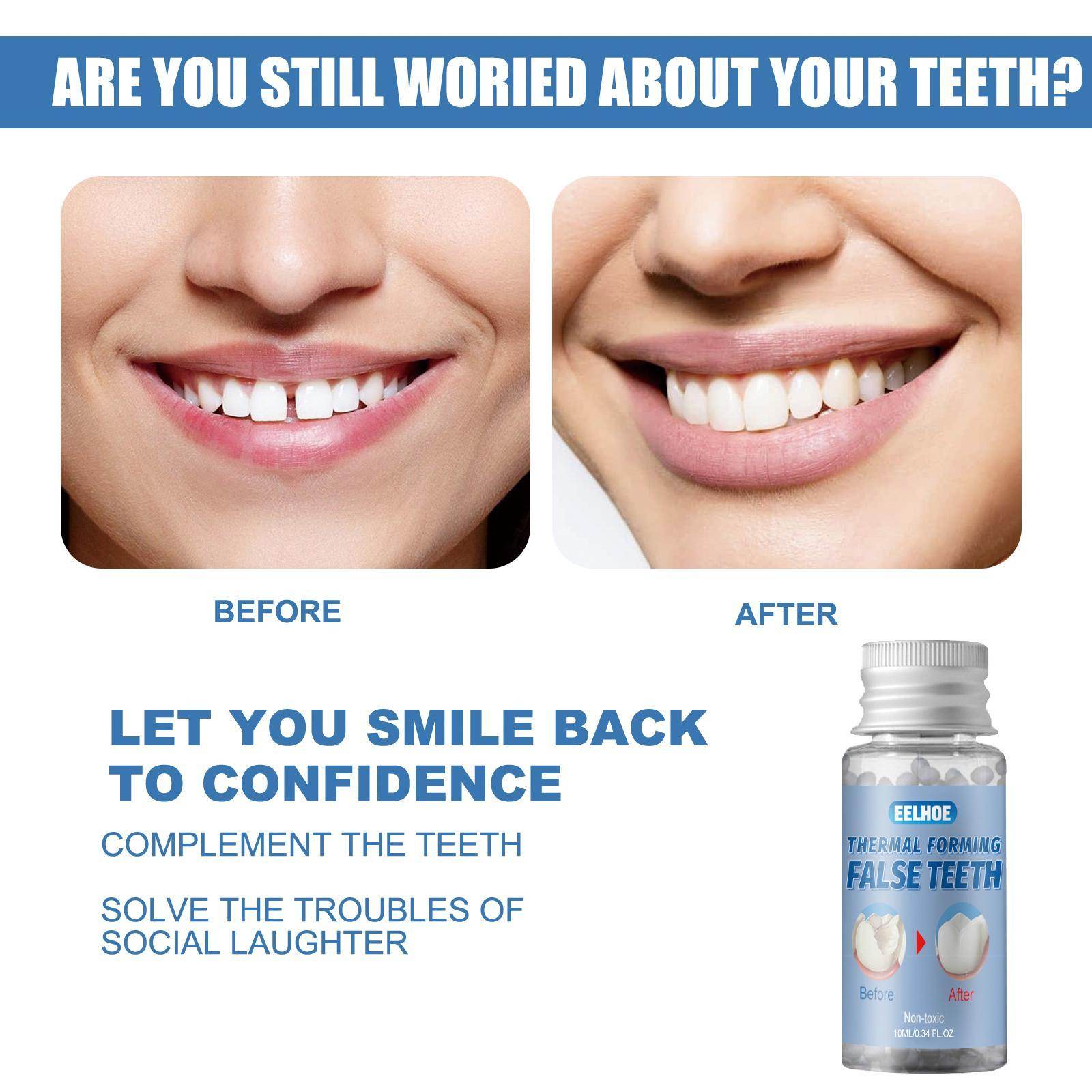 Easy-to-use Tooth Shaping Glue Video Beauty Denture Correction Temporary Filling - Velora