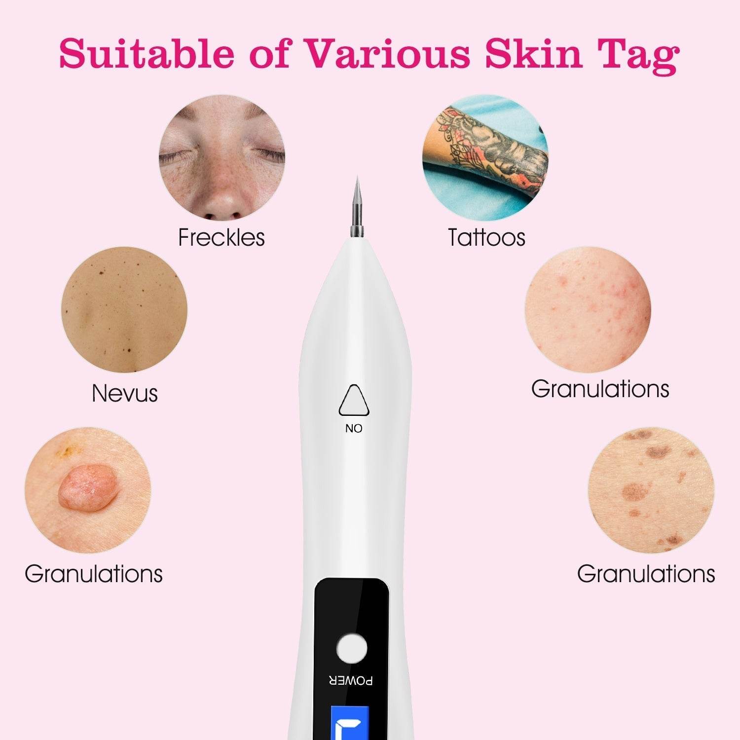1Pc Skin Tag Repair Kit Portable Beauty Equipment Multi-Level With Home Usage USB Charging LCD Level Adjustable 6 Replaceable Needles - Velora
