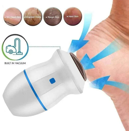 Exfoliate Dead Skin Callus Remover Heel Electric Vacuum Foot Grinder File Machine - Velora