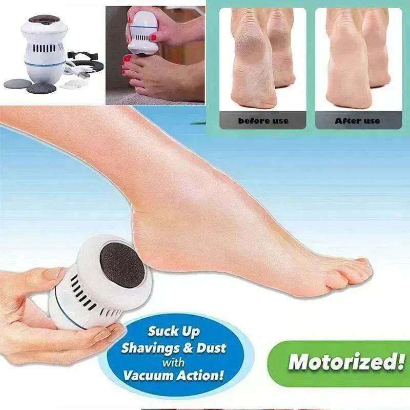 Exfoliate Dead Skin Callus Remover Heel Electric Vacuum Foot Grinder File Machine - Velora