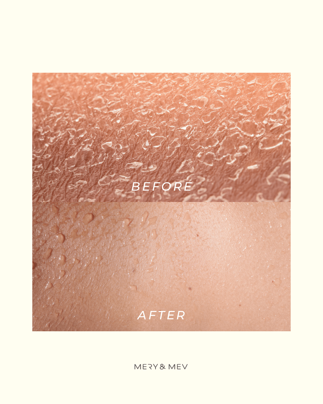 Exfoliating Gloves Family Bundle 4PC - Velora Luxury Fashion