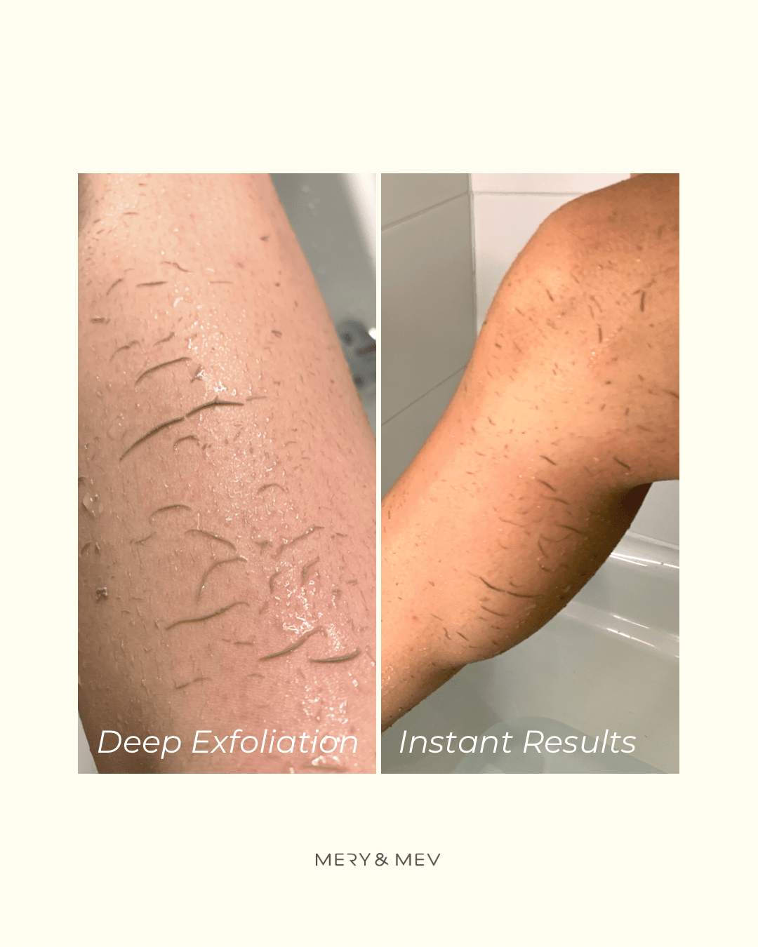 Exfoliating Gloves Family Bundle 4PC - Velora Luxury Fashion