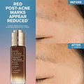 Advanced Night Repair Rescue Solution Serum with 15% Bifidus Ferment - Velora Luxury Fashion