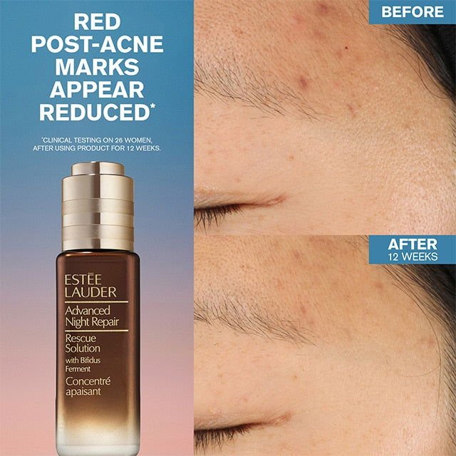 Advanced Night Repair Rescue Solution Serum with 15% Bifidus Ferment - Velora Luxury Fashion
