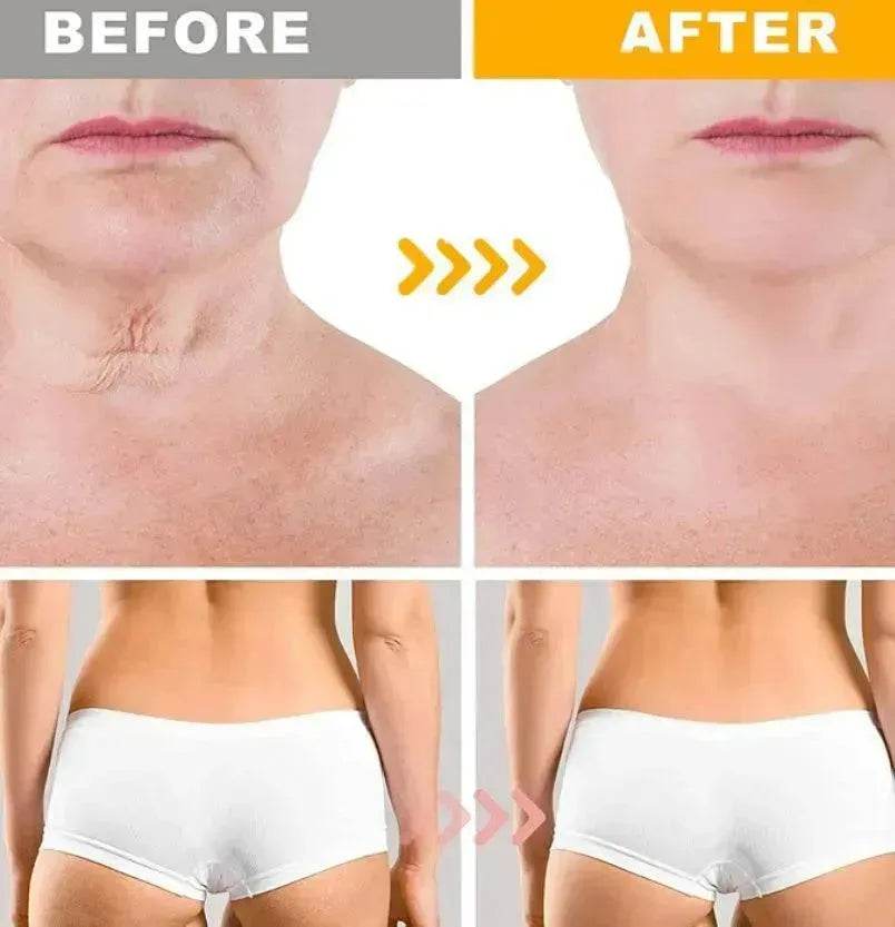 Crazylife Bee Venom Dual-purpose Body Face Repair Cream - Velora