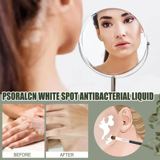 EELHOE White Spot Cleansing Serum PSORALCN White Spot Antibacterial Liquid. - Velora